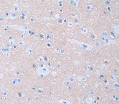 Immunohistochemistry (Formalin/PFA-fixed paraffin-embedded sections) - Anti-Calcineurin B/PPP3R1 antibody (AB231630), expandable thumbnail