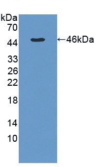 Western blot - Anti-Calcineurin B/PPP3R1 antibody (AB231630), expandable thumbnail