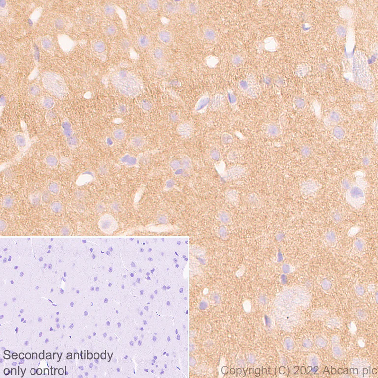 Immunohistochemistry (Formalin/PFA-fixed paraffin-embedded sections) - Anti-Calcineurin B/PPP3R1 antibody [EPR24992-18] (AB303482)