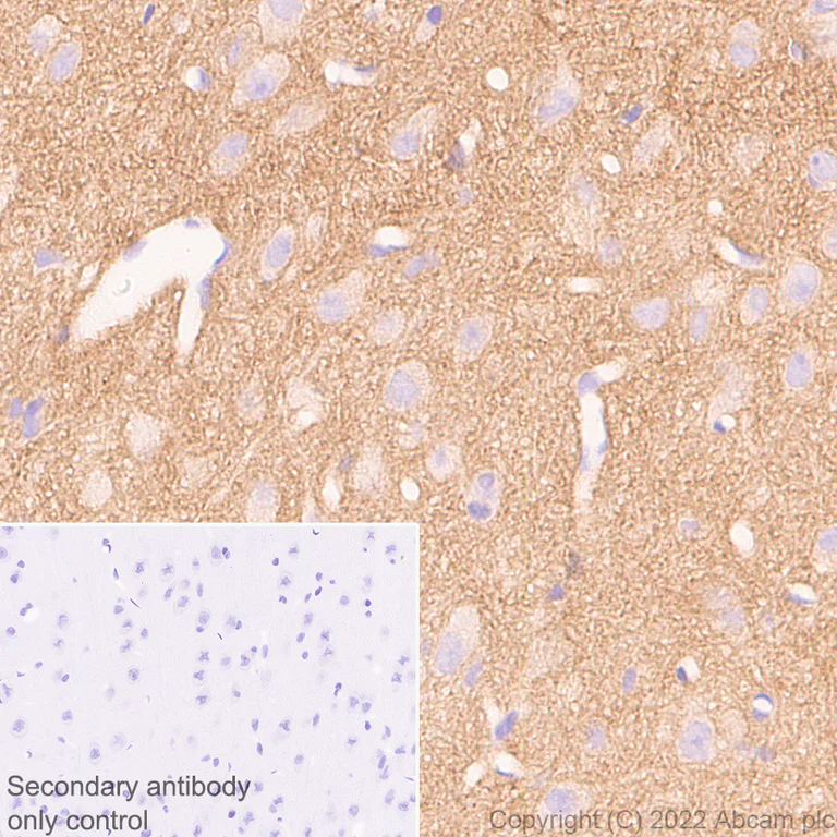 Immunohistochemistry (Formalin/PFA-fixed paraffin-embedded sections) - Anti-Calcineurin B/PPP3R1 antibody [EPR24992-18] (AB303482)