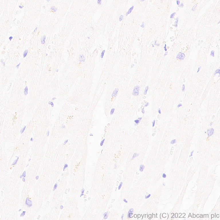Immunohistochemistry (Formalin/PFA-fixed paraffin-embedded sections) - Anti-Calcineurin B/PPP3R1 antibody [EPR24992-18] (AB303482)