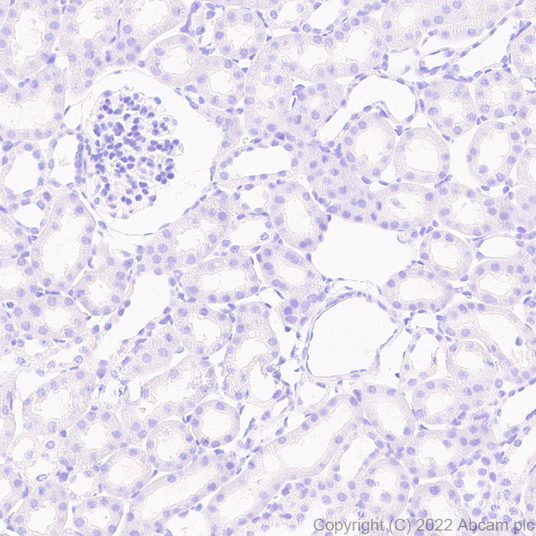 Immunohistochemistry (Formalin/PFA-fixed paraffin-embedded sections) - Anti-Calcineurin B/PPP3R1 antibody [EPR24992-18] (AB303482)