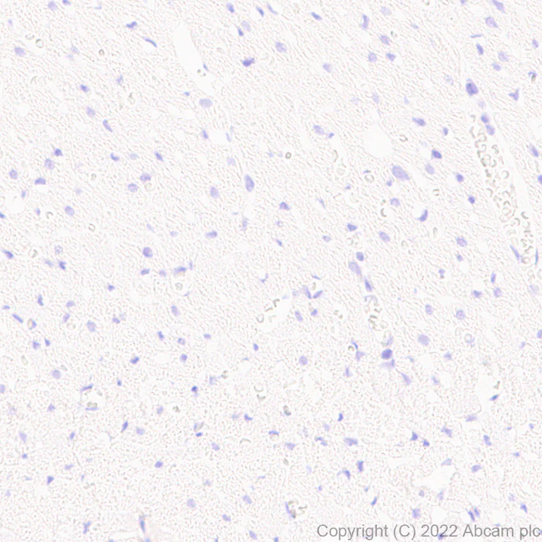 Immunohistochemistry (Formalin/PFA-fixed paraffin-embedded sections) - Anti-Calcineurin B/PPP3R1 antibody [EPR24992-18] (AB303482)