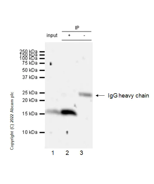 Immunoprecipitation - Anti-Calcineurin B/PPP3R1 antibody [EPR24992-18] (AB303482)