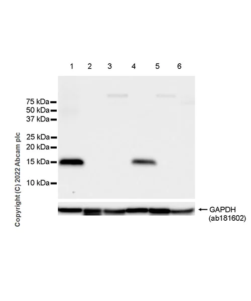 Western blot - Anti-Calcineurin B/PPP3R1 antibody [EPR24992-18] (AB303482)