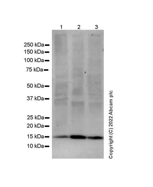 Western blot - Anti-Calcineurin B/PPP3R1 antibody [EPR24992-18] (AB303482)