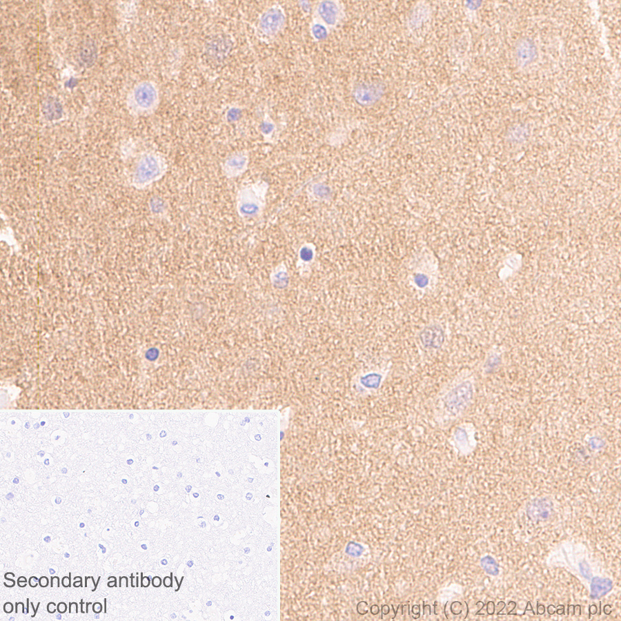 Immunohistochemistry (Formalin/PFA-fixed paraffin-embedded sections) - Anti-Calcineurin B/PPP3R1 + Calcineurin BII/PPP3R2 antibody [EPR24992-14] (ab303562), expandable thumbnail