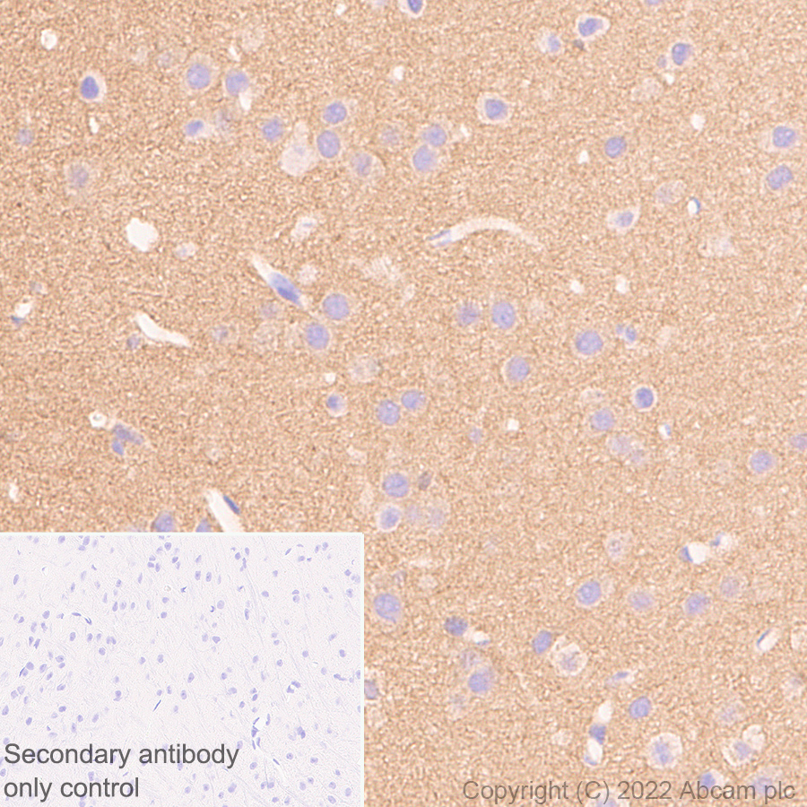Immunohistochemistry (Formalin/PFA-fixed paraffin-embedded sections) - Anti-Calcineurin B/PPP3R1 + Calcineurin BII/PPP3R2 antibody [EPR24992-14] (ab303562), expandable thumbnail