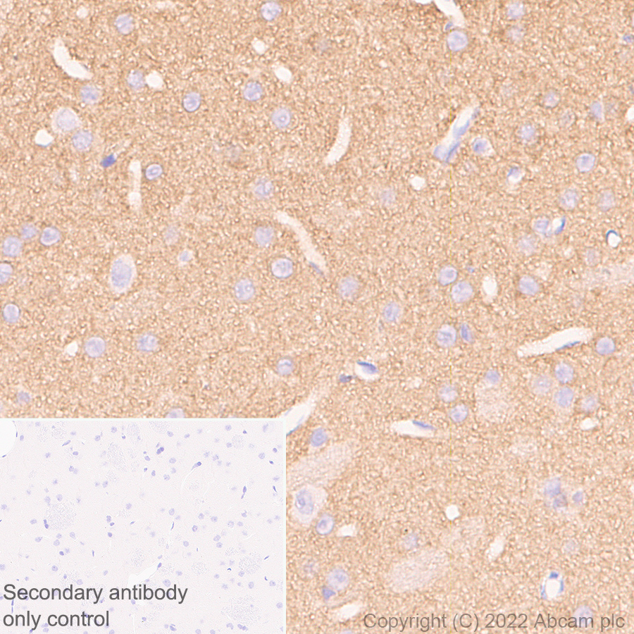 Immunohistochemistry (Formalin/PFA-fixed paraffin-embedded sections) - Anti-Calcineurin B/PPP3R1 + Calcineurin BII/PPP3R2 antibody [EPR24992-14] (ab303562), expandable thumbnail