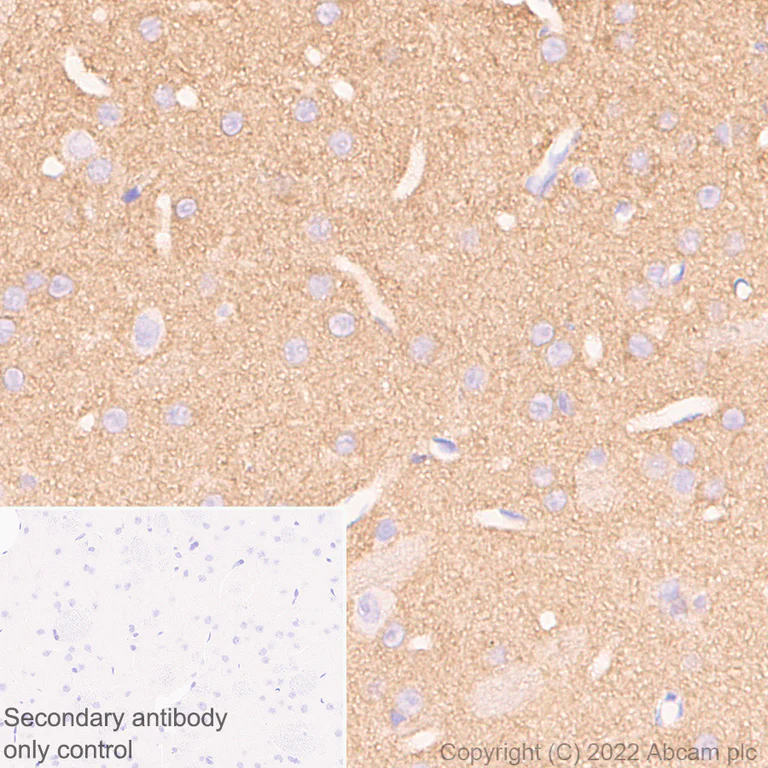 Immunohistochemistry (Formalin/PFA-fixed paraffin-embedded sections) - Anti-Calcineurin B/PPP3R1 + Calcineurin BII/PPP3R2 antibody [EPR24992-14] (AB303562)