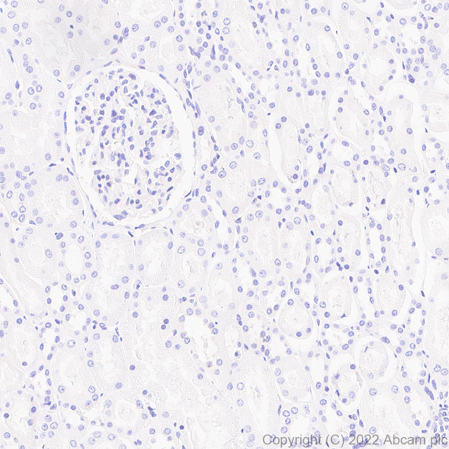 Immunohistochemistry (Formalin/PFA-fixed paraffin-embedded sections) - Anti-Calcineurin B/PPP3R1 + Calcineurin BII/PPP3R2 antibody [EPR24992-14] (ab303562), expandable thumbnail