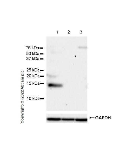 Western blot - Anti-Calcineurin B/PPP3R1 + Calcineurin BII/PPP3R2 antibody [EPR24992-14] (AB303562), expandable thumbnail