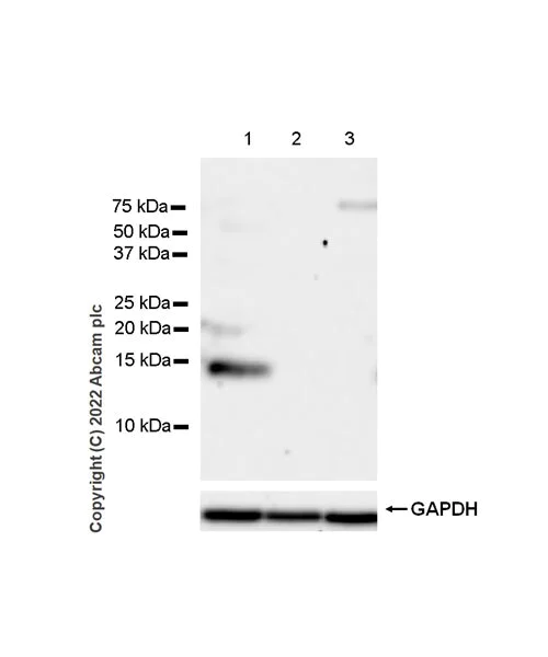 Western blot - Anti-Calcineurin B/PPP3R1 + Calcineurin BII/PPP3R2 antibody [EPR24992-14] (AB303562)