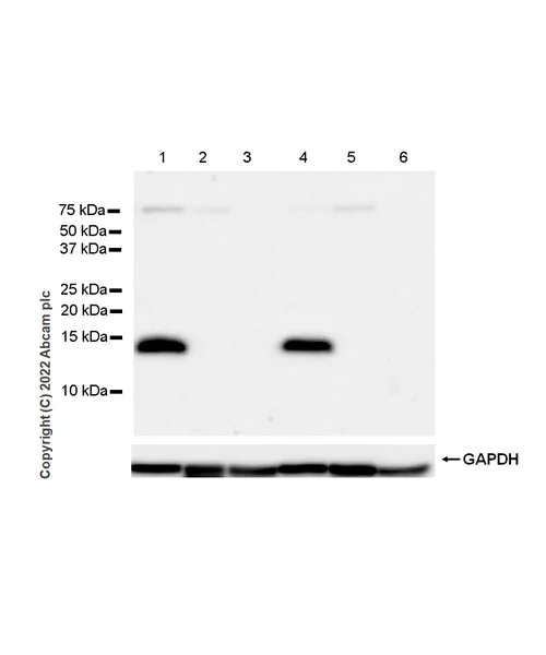 Western blot - Anti-Calcineurin B/PPP3R1 + Calcineurin BII/PPP3R2 antibody [EPR24992-14] (AB303562)