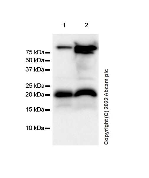 Western blot - Anti-Calcineurin B/PPP3R1 + Calcineurin BII/PPP3R2 antibody [EPR24992-14] (AB303562), expandable thumbnail