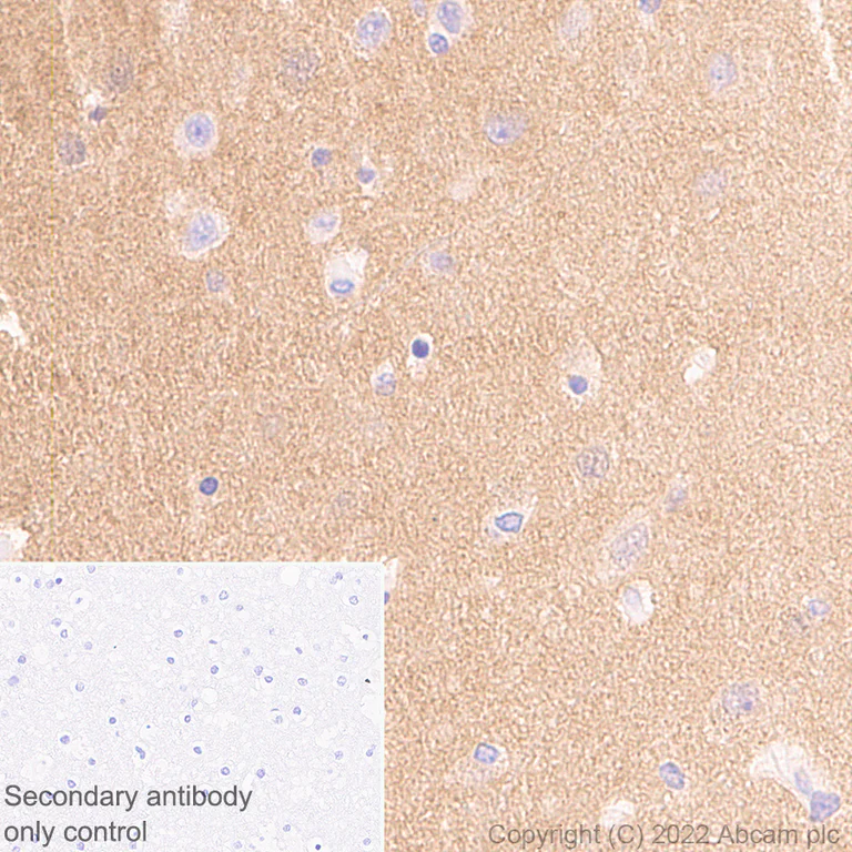Immunohistochemistry (Formalin/PFA-fixed paraffin-embedded sections) - Anti-Calcineurin B/PPP3R1 + Calcineurin BII/PPP3R2 antibody [EPR24992-14] - BSA and Azide free (AB303563)