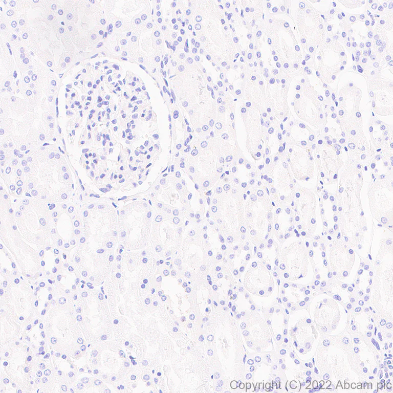 Immunohistochemistry (Formalin/PFA-fixed paraffin-embedded sections) - Anti-Calcineurin B/PPP3R1 + Calcineurin BII/PPP3R2 antibody [EPR24992-14] - BSA and Azide free (AB303563)