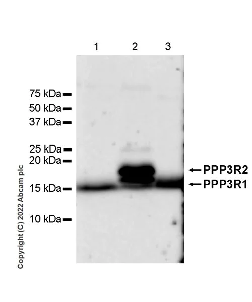 Western blot - Anti-Calcineurin B/PPP3R1 + Calcineurin BII/PPP3R2 antibody [EPR24992-14] - BSA and Azide free (AB303563)