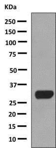 Western blot - Anti-Calcipressin 1/RCAN1 antibody [EPR8911] - BSA and Azide free (AB248891)