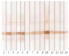 Western blot - Anti-Calcitonin antibody [16B5] (AB11493)