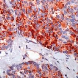 Immunohistochemistry (Formalin/PFA-fixed paraffin-embedded sections) - Anti-Calcitonin antibody (AB8553)