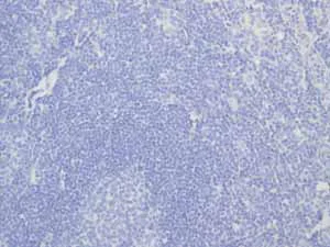 Immunohistochemistry (Formalin/PFA-fixed paraffin-embedded sections) - Anti-Calcitonin antibody [EPR68(2)] (AB133235)