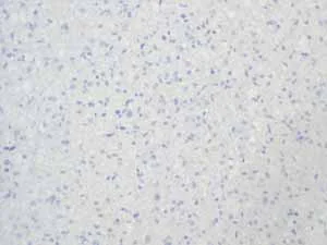 Immunohistochemistry (Formalin/PFA-fixed paraffin-embedded sections) - Anti-Calcitonin antibody [EPR68(2)] (AB133235)