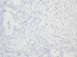 Immunohistochemistry (Formalin/PFA-fixed paraffin-embedded sections) - Anti-Calcitonin antibody [EPR68(2)] (AB133235)