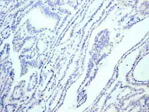Immunohistochemistry (Formalin/PFA-fixed paraffin-embedded sections) - Anti-Calcitonin antibody [EPR68(2)] (AB133235)