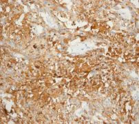 Immunohistochemistry (Formalin/PFA-fixed paraffin-embedded sections) - Anti-Calcitonin antibody [EPR68(2)] (AB133235)