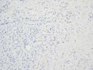 Immunohistochemistry (Formalin/PFA-fixed paraffin-embedded sections) - Anti-Calcitonin antibody [EPR68(2)] (AB133235)