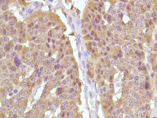 Immunohistochemistry (Formalin/PFA-fixed paraffin-embedded sections) - Anti-Calcitonin antibody [SP17] (AB16697)
