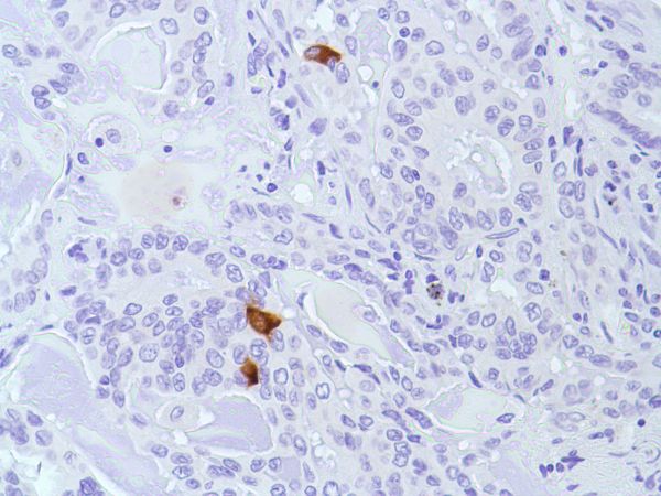 Immunohistochemistry (Formalin/PFA-fixed paraffin-embedded sections) - Anti-Calcitonin antibody [SP17] (AB16697)
