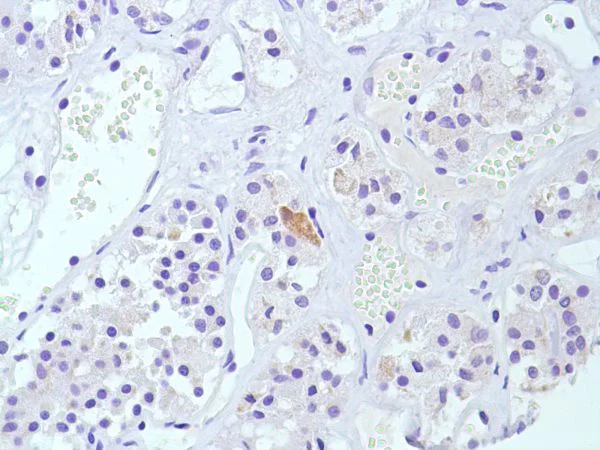 Immunohistochemistry (Formalin/PFA-fixed paraffin-embedded sections) - Anti-Calcitonin antibody [SP17] - BSA and Azide free (AB240922)