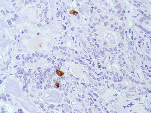 Immunohistochemistry (Formalin/PFA-fixed paraffin-embedded sections) - Anti-Calcitonin antibody [SP17] - BSA and Azide free (AB240922)