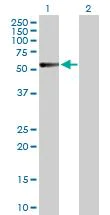 Western blot - Anti-Calcitonin receptor/CT-R antibody (AB103422)