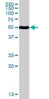 Western blot - Anti-Calcitonin receptor/CT-R antibody (AB103422)