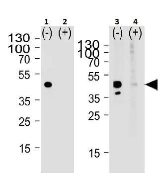 Western blot - Anti-Calcitonin receptor/CT-R antibody (AB230500)