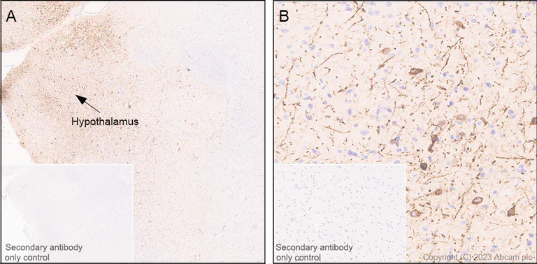 Immunohistochemistry (Formalin/PFA-fixed paraffin-embedded sections) - Anti-Calcitonin receptor/CT-R antibody [EPR27455-47] (AB313335)