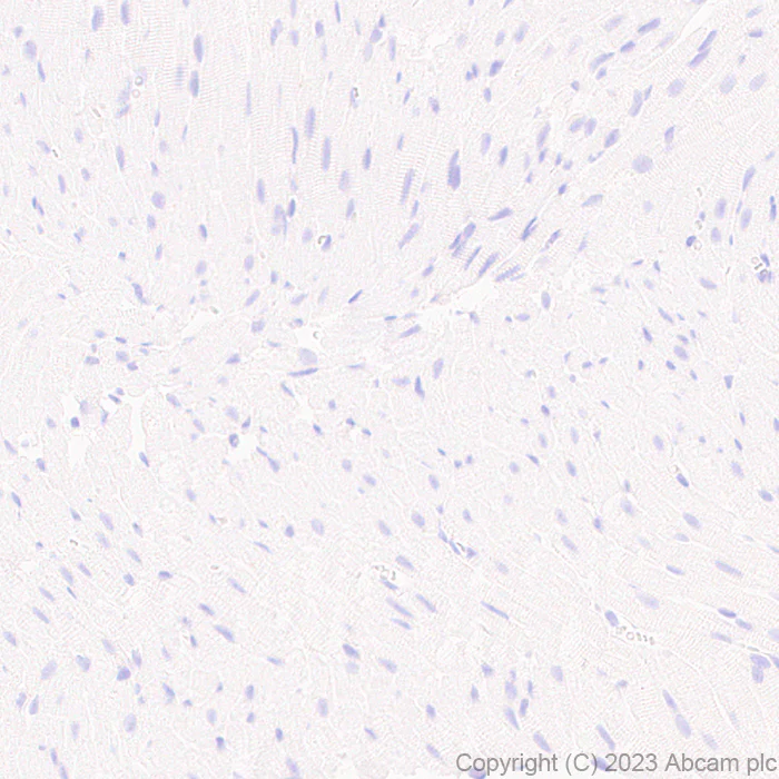 Immunohistochemistry (Formalin/PFA-fixed paraffin-embedded sections) - Anti-Calcitonin receptor/CT-R antibody [EPR27455-47] (AB313335)