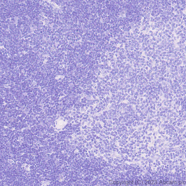 Immunohistochemistry (Formalin/PFA-fixed paraffin-embedded sections) - Anti-Calcitonin receptor/CT-R antibody [EPR27455-47] - BSA and Azide free (AB313336)