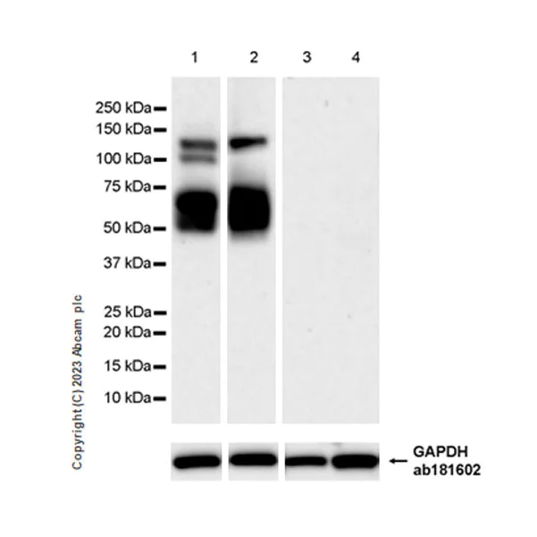 Western blot - Anti-Calcitonin receptor/CT-R antibody [EPR27455-47] - BSA and Azide free (AB313336)