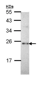 Western blot - Anti-Calcium binding protein P22 antibody (AB96203)