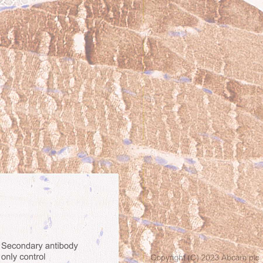 Immunohistochemistry (Formalin/PFA-fixed paraffin-embedded sections) - Anti-Calcium channel L type DHPR alpha 2 subunit/CACNA2D1 antibody [EPR23267-59] (ab313763), expandable thumbnail