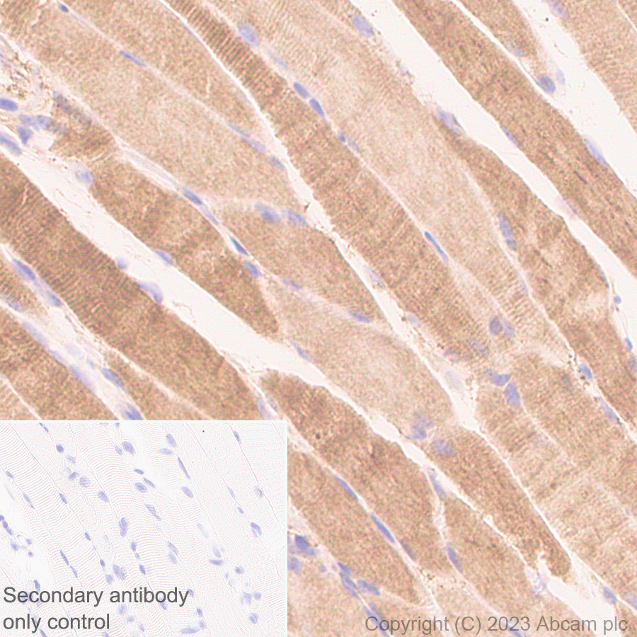 Immunohistochemistry (Formalin/PFA-fixed paraffin-embedded sections) - Anti-Calcium channel L type DHPR alpha 2 subunit/CACNA2D1 antibody [EPR23267-59] (ab313763), expandable thumbnail