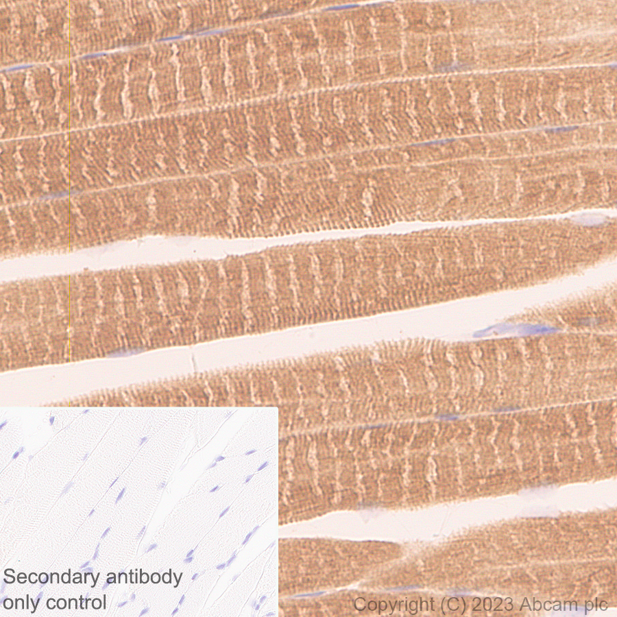 Immunohistochemistry (Formalin/PFA-fixed paraffin-embedded sections) - Anti-Calcium channel L type DHPR alpha 2 subunit/CACNA2D1 antibody [EPR23267-59] (ab313763), expandable thumbnail
