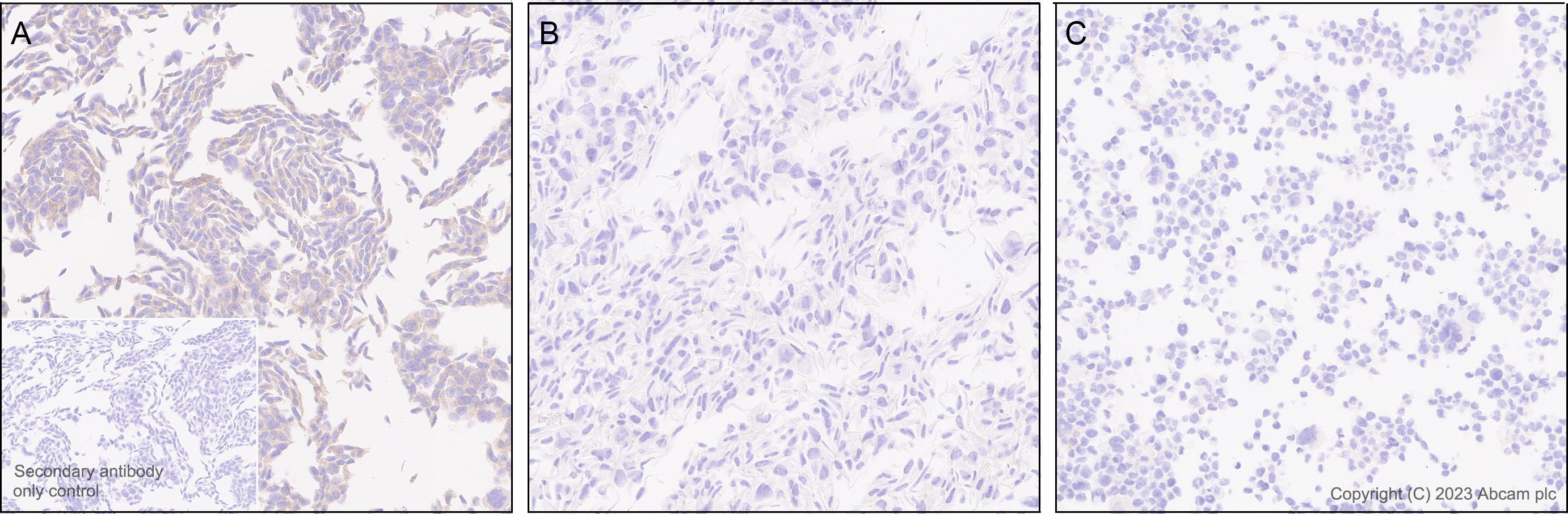Immunohistochemistry (Formalin/PFA-fixed paraffin-embedded sections) - Anti-Calcium channel L type DHPR alpha 2 subunit/CACNA2D1 antibody [EPR23267-59] (AB313763), expandable thumbnail