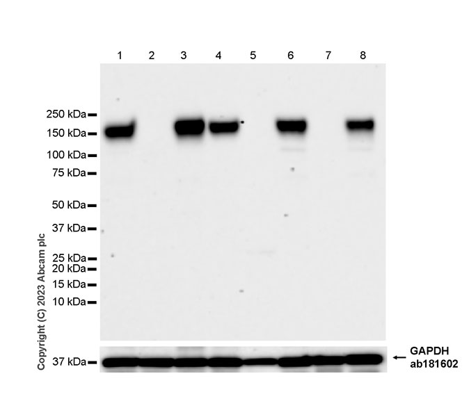 Western blot - Anti-Calcium channel L type DHPR alpha 2 subunit/CACNA2D1 antibody [EPR23267-59] (AB313763), expandable thumbnail