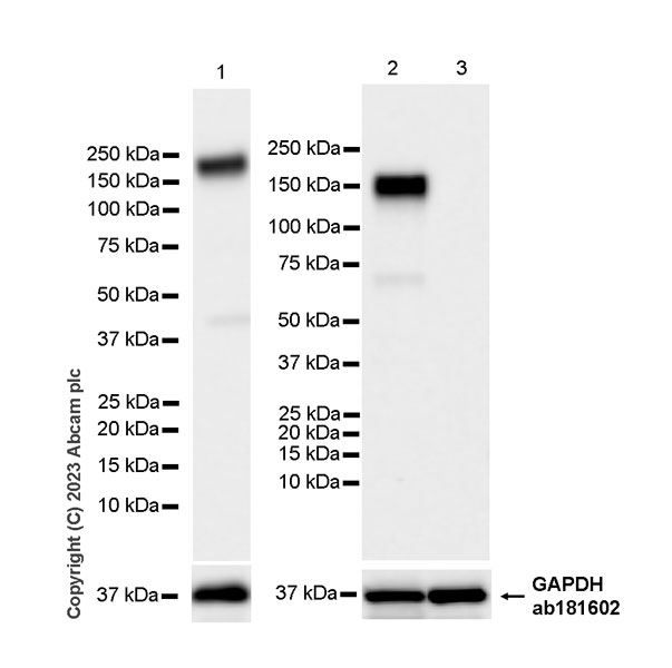 Western blot - Anti-Calcium channel L type DHPR alpha 2 subunit/CACNA2D1 antibody [EPR23267-59] (AB313763), expandable thumbnail
