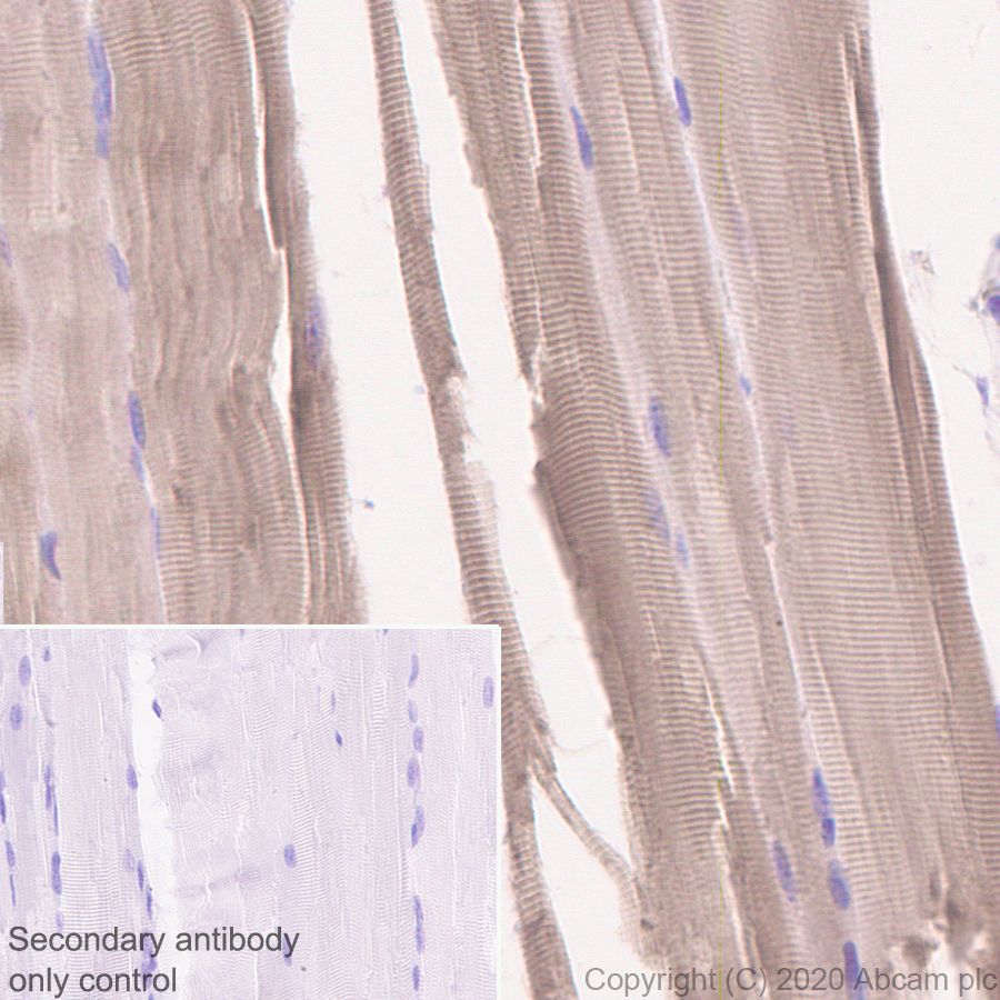 Immunohistochemistry (Formalin/PFA-fixed paraffin-embedded sections) - Anti-Calcium channel L type DHPR alpha 2 subunit/CACNA2D1 antibody [EPR23267-8] (AB253190)